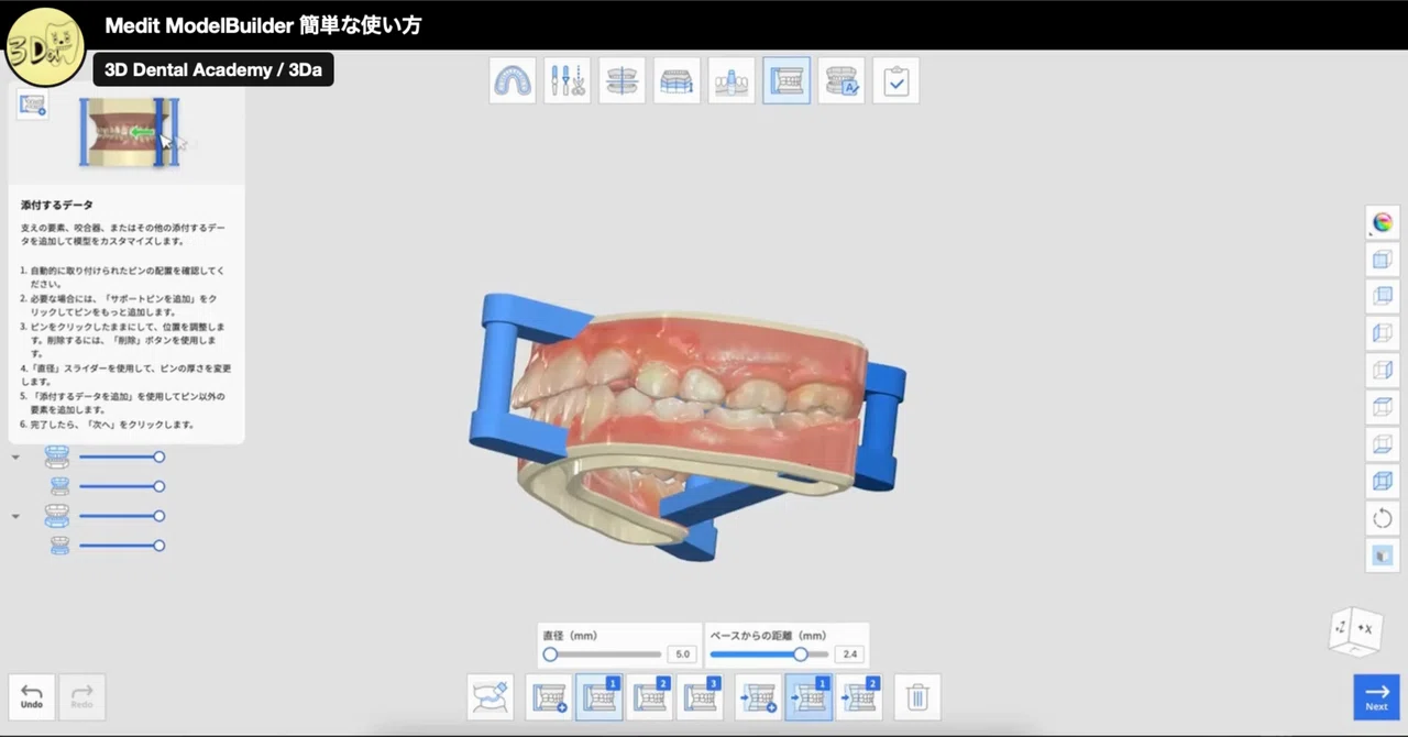 (Basic) Medit Model Builderの使い方｜3D歯科
