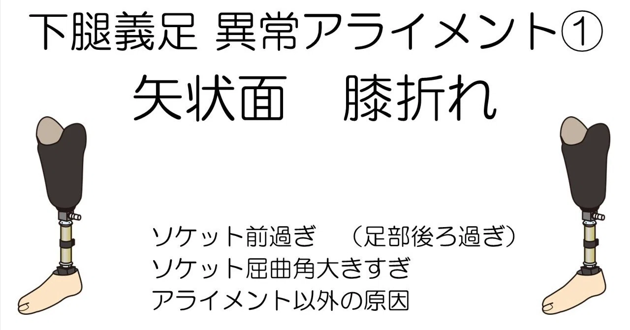 下腿義足 異常アライメント 膝折れ編｜じょんがらPT
