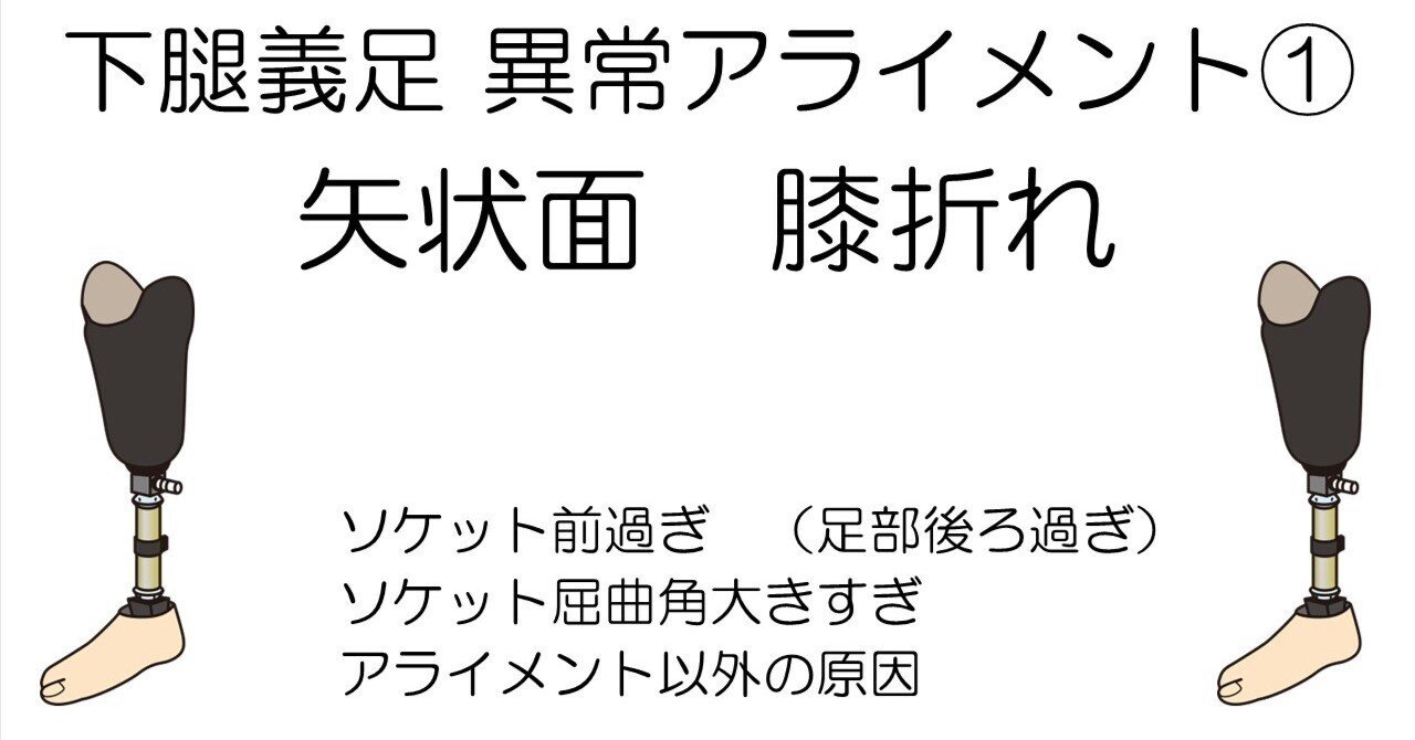 下腿義足 異常アライメント 膝折れ編｜じょんがらPT