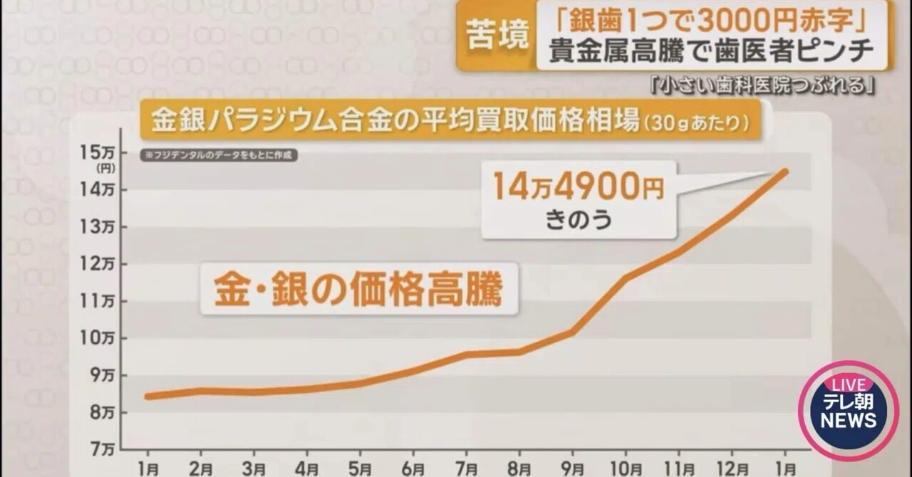 銀歯（パラジウム合金）を中止するという判断について｜Dr.勝