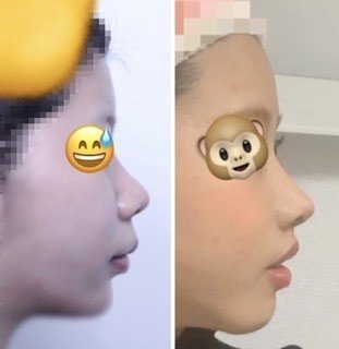 人中短縮をした話し もはんしゅう Note