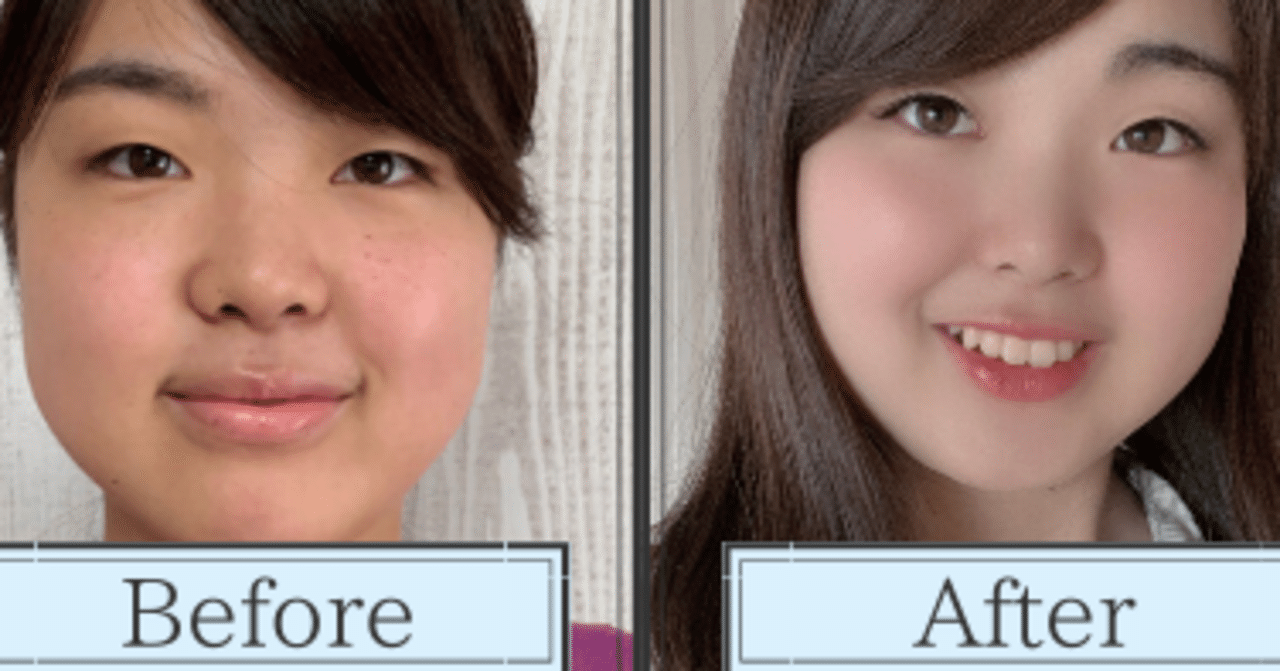 美白スキンケアで効果が出ないたった一つの理由 美容オタ やまあすが教える 学校では教えてくれない 美容 マインド Note