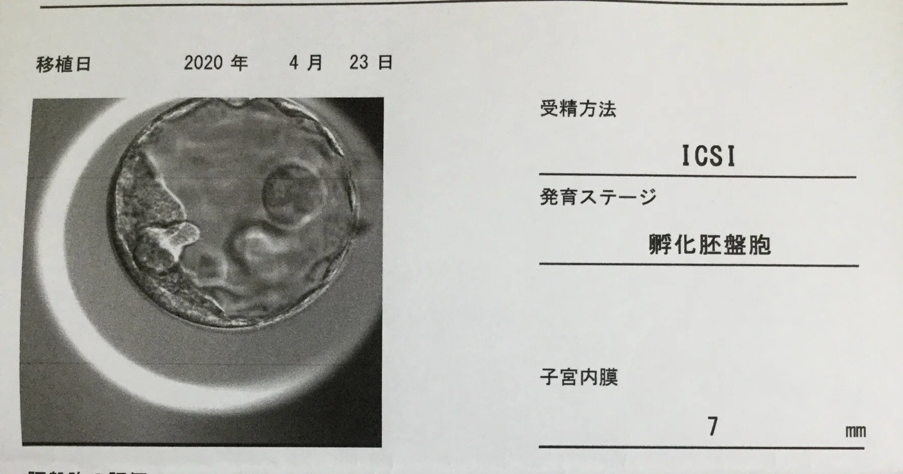 Klc転院後 採卵 凍結 子宮鏡手術 移植までの記録 にこ天使ママ Note