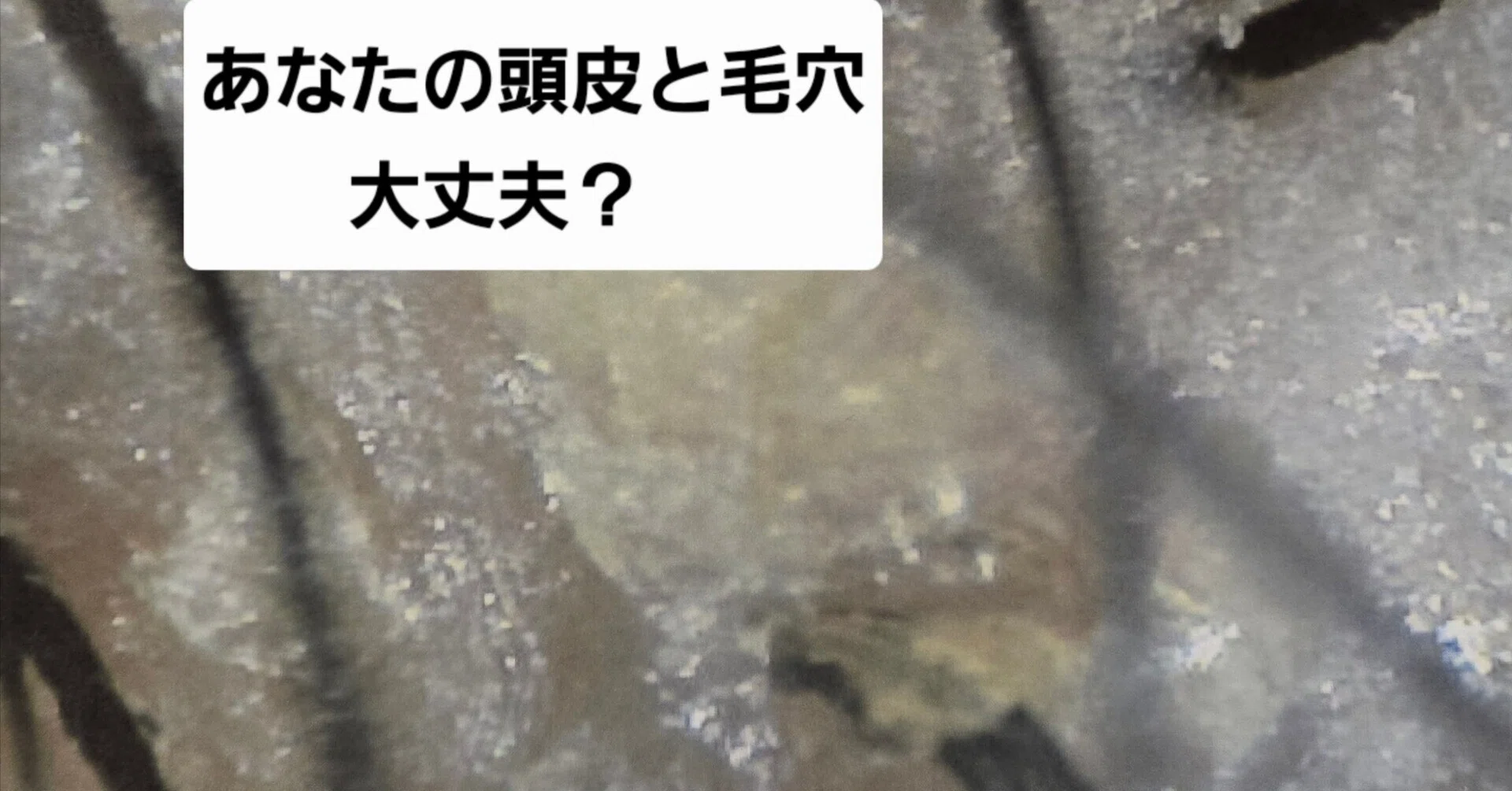 40代50代男性の頭皮診断で分かった真実。あなたの頭皮は大丈夫ですか 