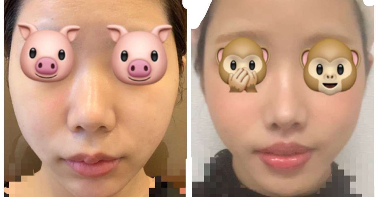 人中短縮 の新着タグ記事一覧 Note つくる つながる とどける