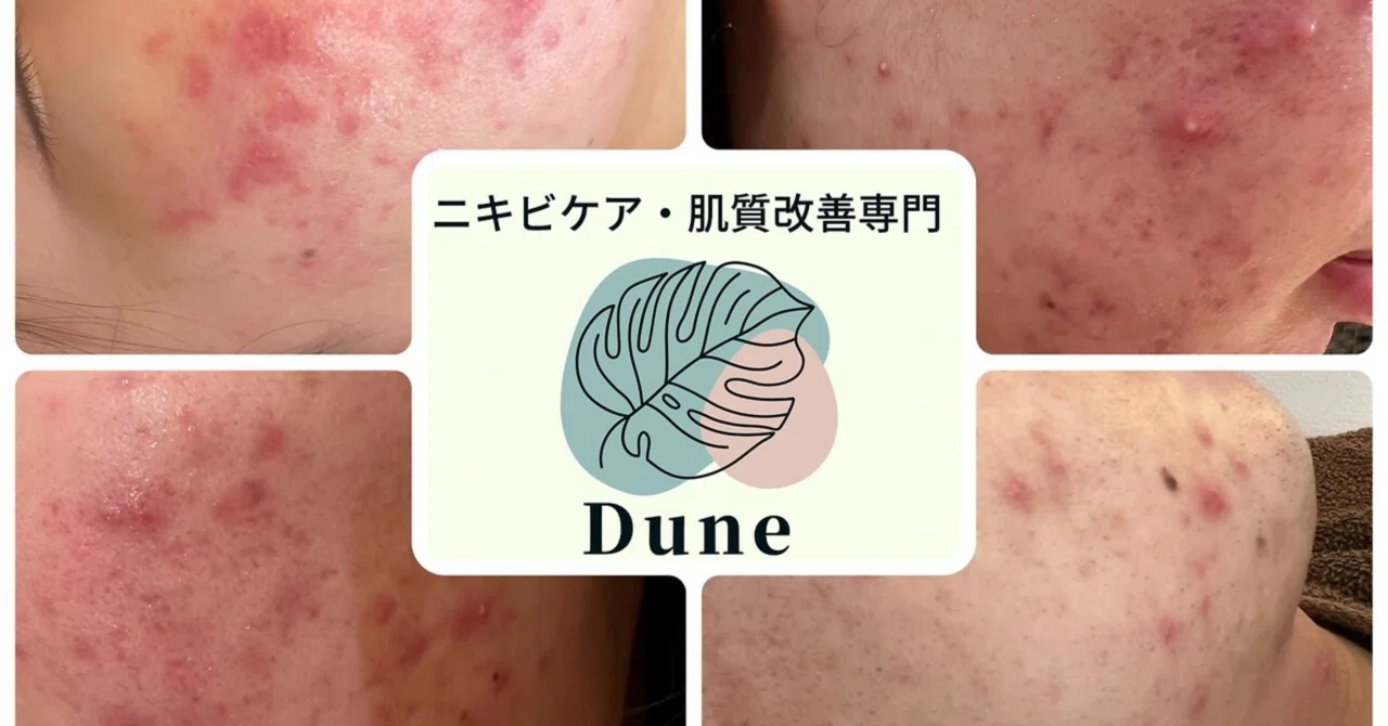Our Shop's Recommendation! Human Umbilical Cord Blood Stem Cell Facial ...