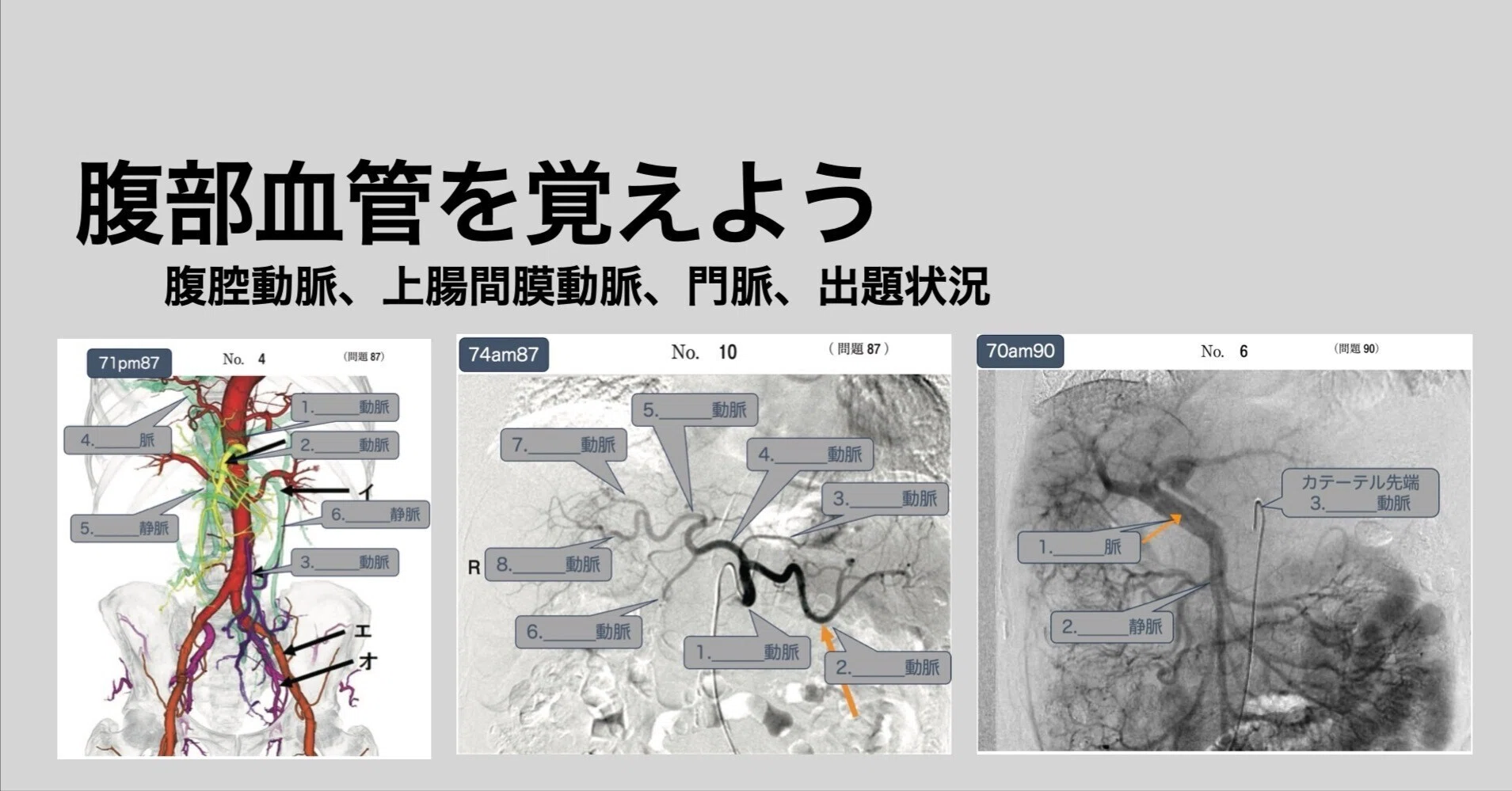 腹部血管を覚えよう｜kawash