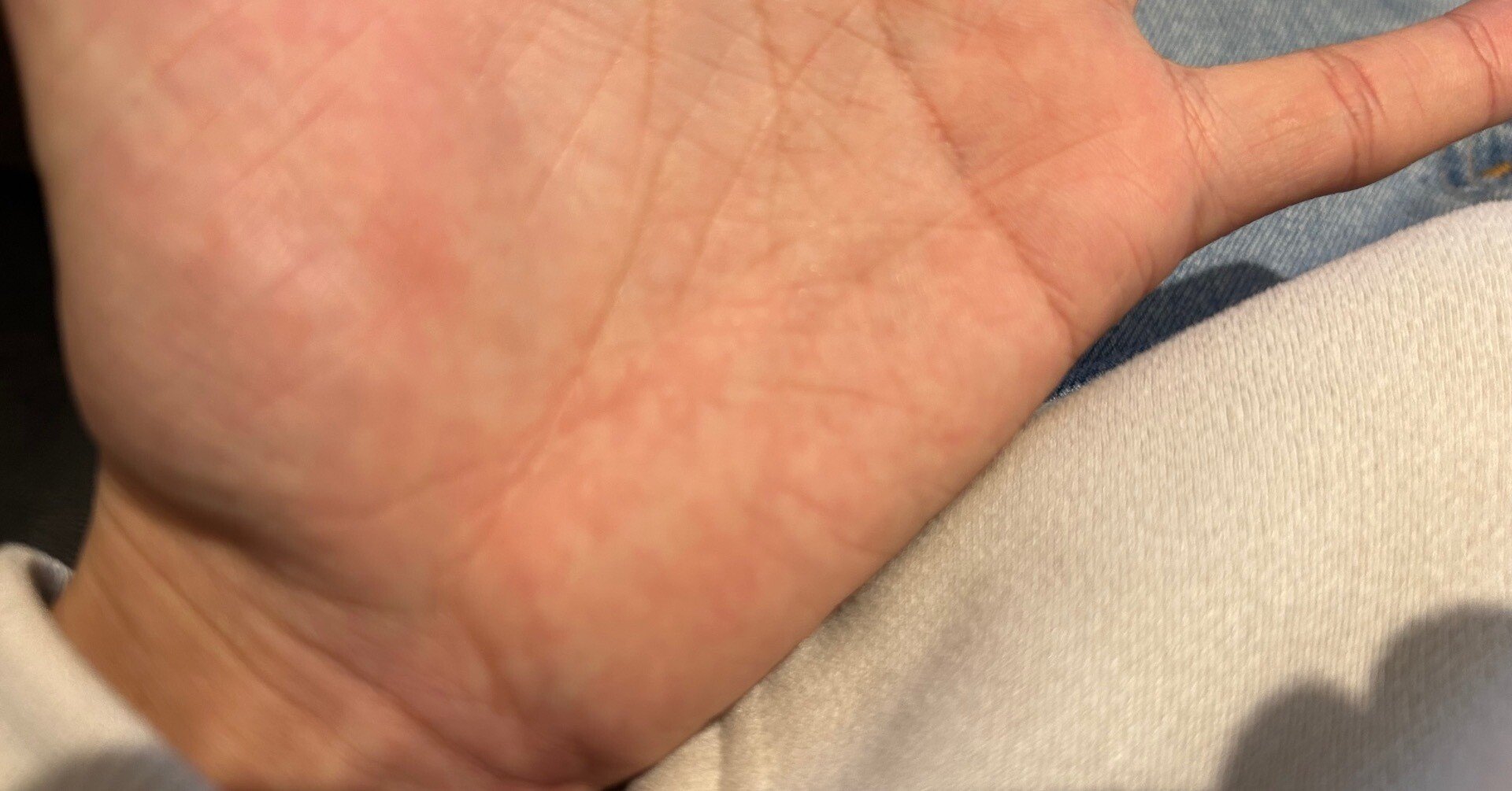 手相で病気を早期発見 ORANGE BACKS 手相で病気を早期発見 ORANGE