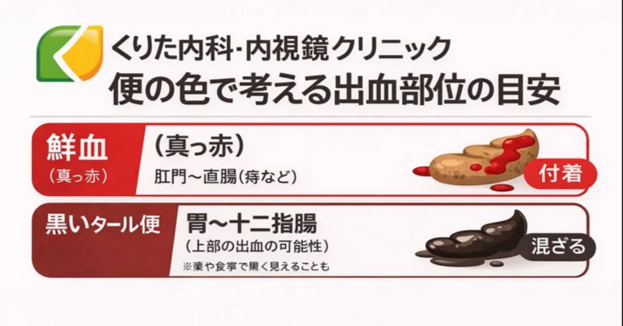 血便・黒い便(タール便)が出た…外来でよくある原因と、受診の目安|くりた内科・内視鏡クリニック