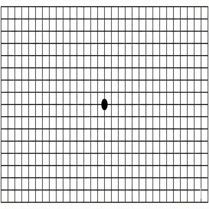 体験談】18歳で失明の危機？「まさか自分が」網膜剥離の恐怖と、日常を取り戻すまでの全記録｜アーカイブトウキョウ