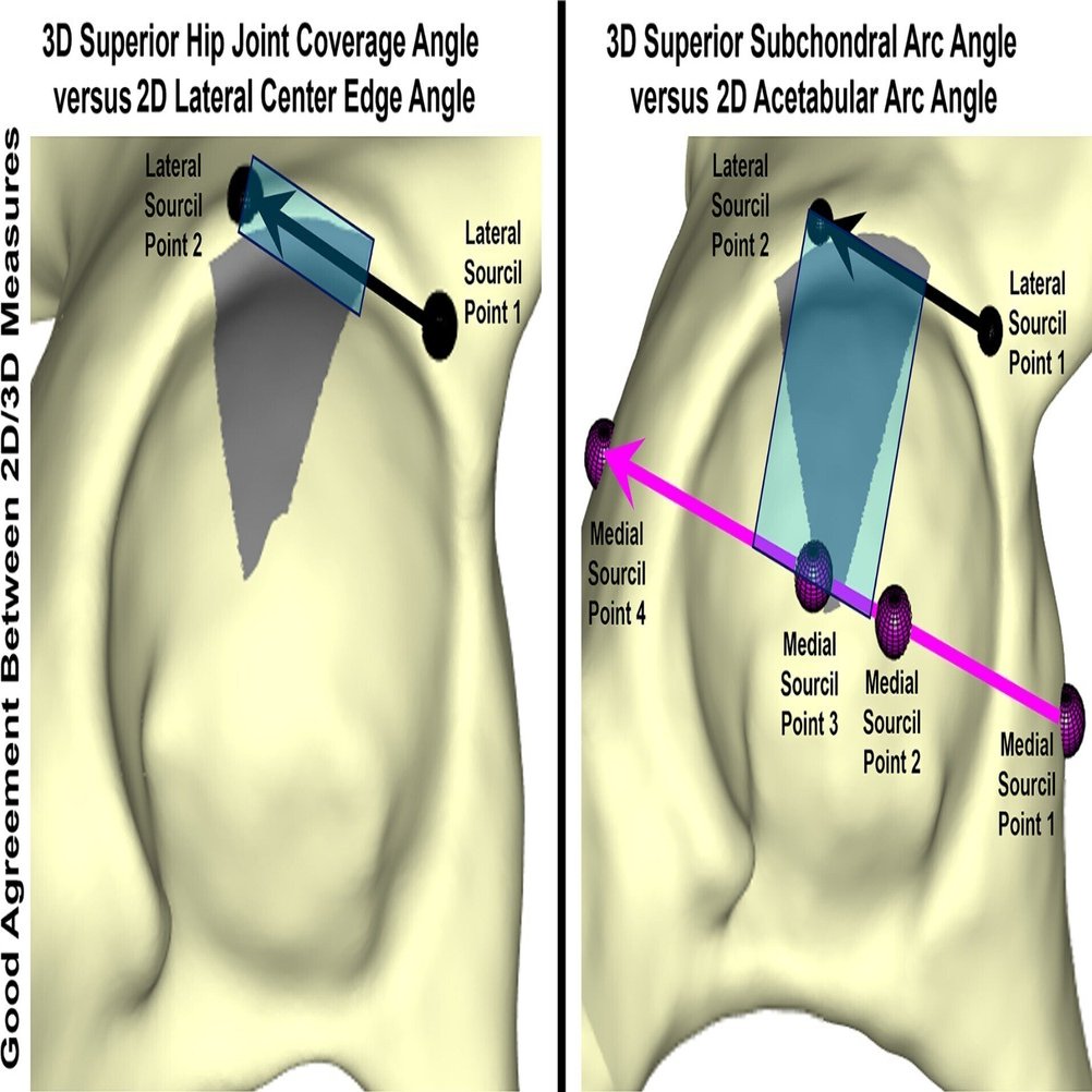 股関節学 股関節学 m3電子書籍 | 股関節学 第2版
