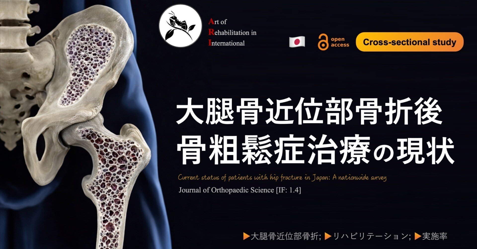 大腿骨近位部骨折後の骨粗鬆症治療の現状｜Super Human | 理学療法士