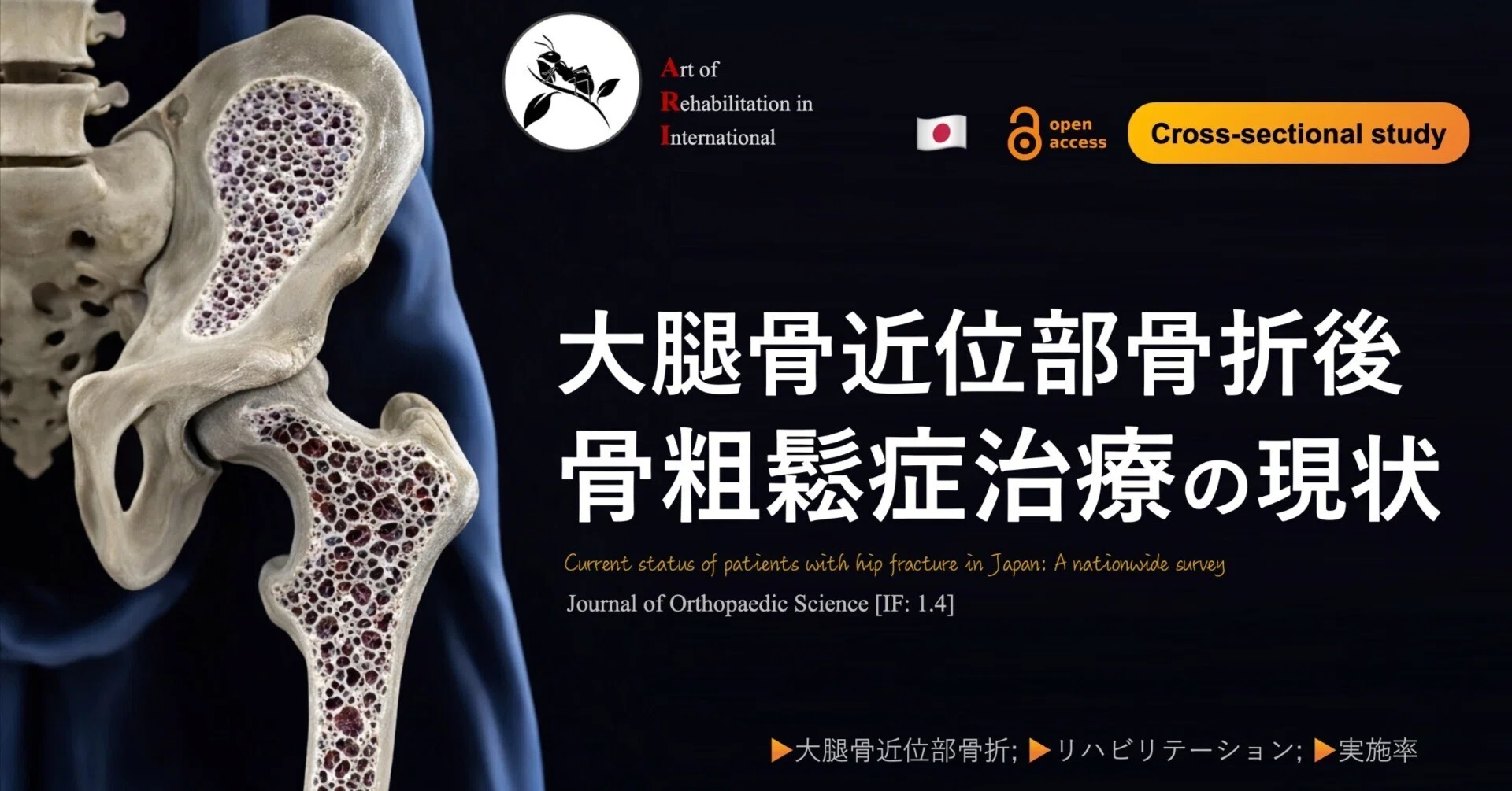 大腿骨近位部骨折後の骨粗鬆症治療の現状｜Super Human | 理学療法士
