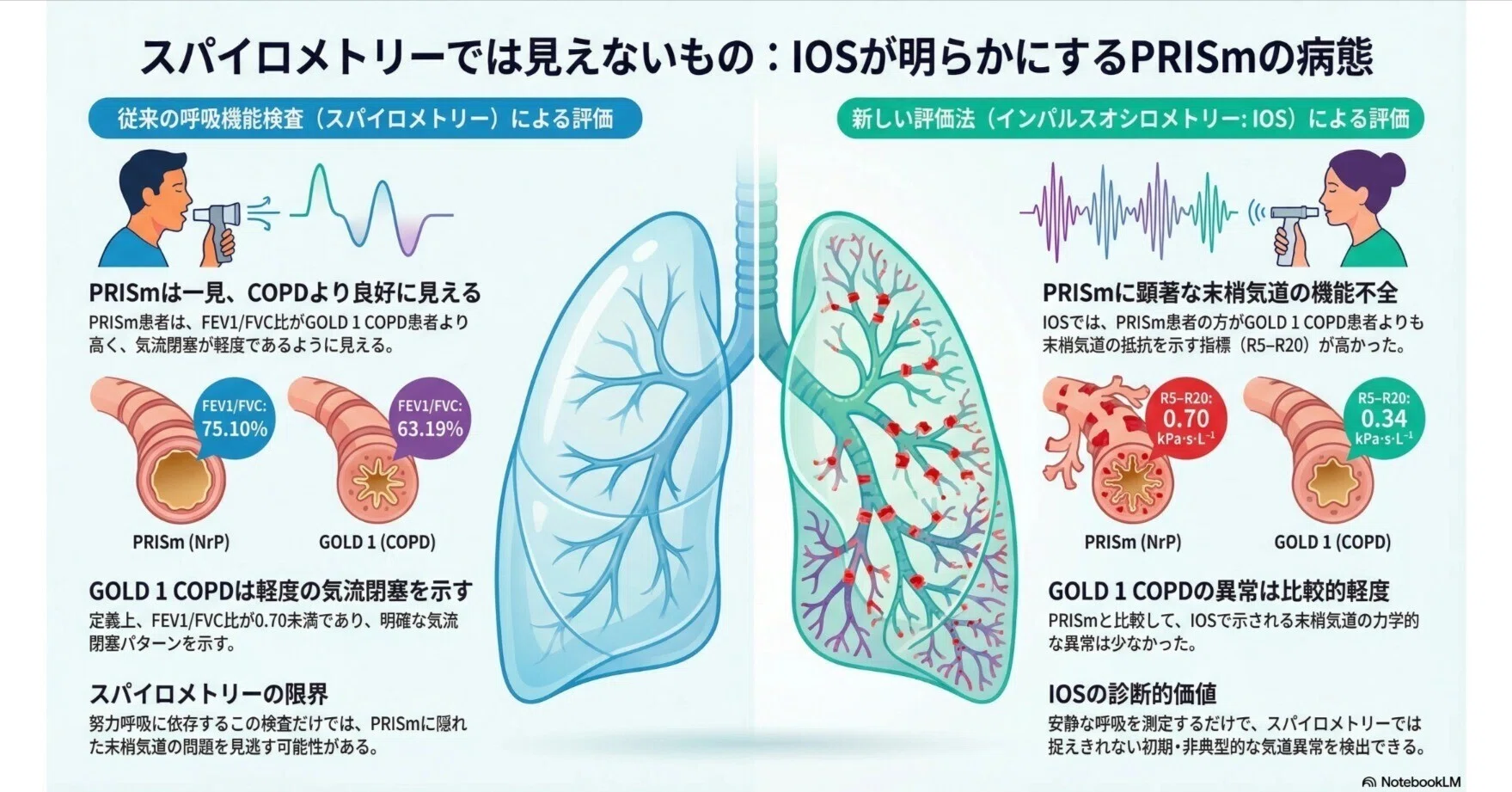 インパルスオシロメトリーおよびスパイロメトリーで評価した、GOLD