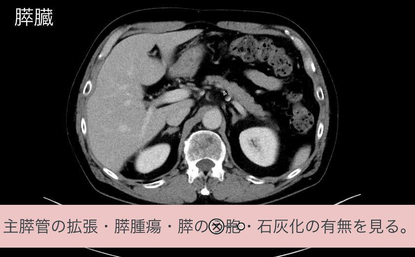 見逃しを防ぐための腹部CTの読影の順番｜ごろ〜にゃ@放射線科医