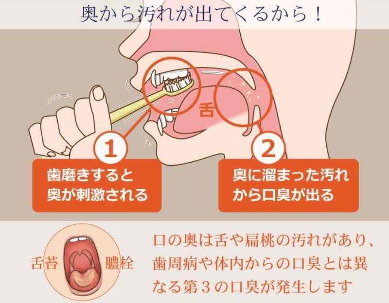 玉 ない 匂い 臭い玉（膿腺）の場所が動画でよくわかる！膿栓動画がヤバ過ぎ…