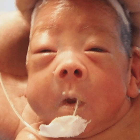超低出生体重児 36枚の写真で見る1年間の顔の成長 0 11か月編 成川潤 Jun Narikawa Note 超低出生体重児 36枚の写真で見る1年間の顔の成長 0 11か月編 成川潤 Jun Narikawa Note