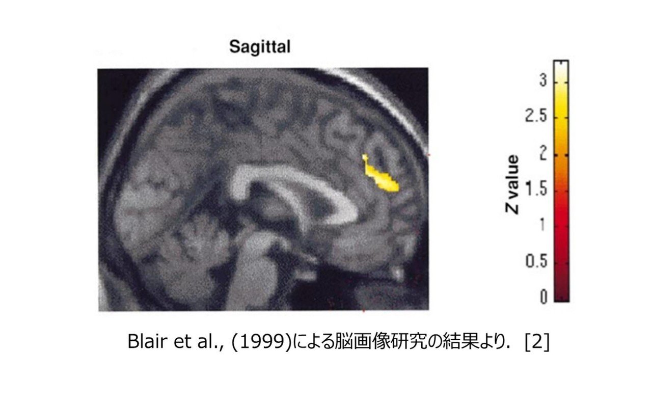 怒った顔はバレやすい 感情の研究って面白い 感情科学 を読んで おにねこ Note