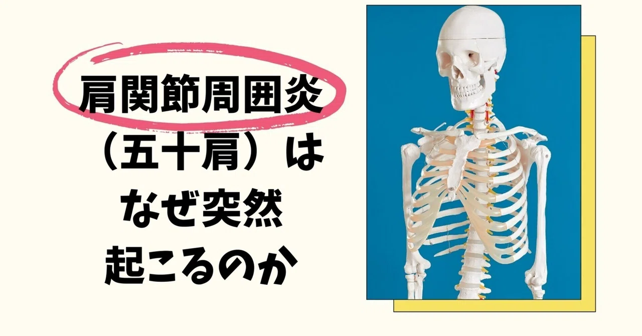 肩関節周囲炎(五十肩)はなぜ突然起こるのか|YUSUKE