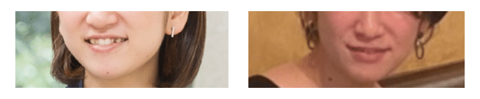 噛めない期を活用 バターコーヒーダイエット 大人の歯列矯正 5ヶ月目前半 Miki Sato Note