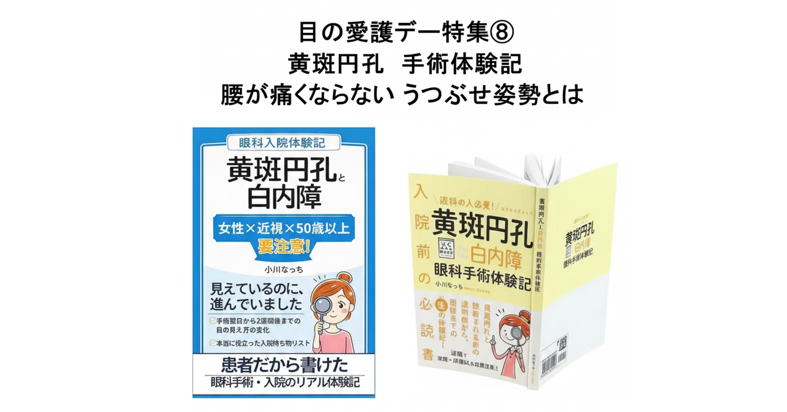 目の愛護デー特集⑧黄斑円孔手術体験記～腰が痛くならない うつぶせ 