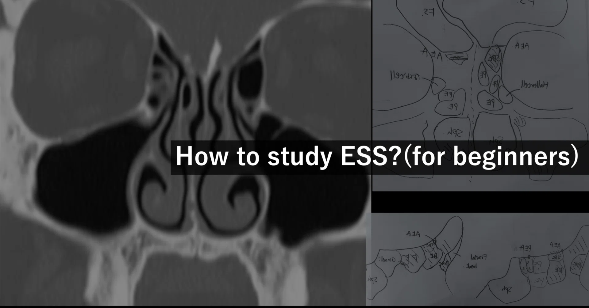 ess 耳鼻 科