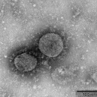 株式会社ベルシステム２４ Bellsystem24 コロナ事件 なぜベルシステム24 はスタッフに対して 多少の熱があっても出勤できるのなら来てください と言ったのか 労働相談 労働問題 Note
