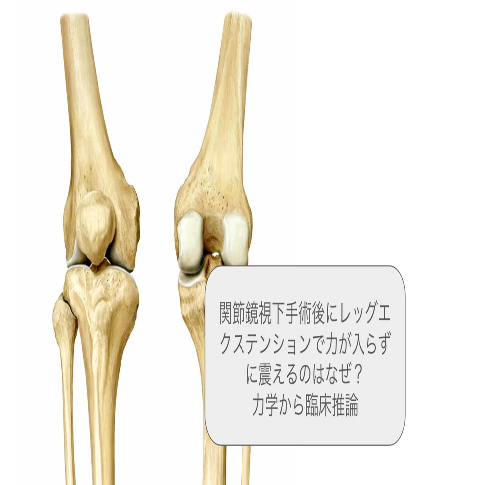 膝関節鏡視下手術後、レッグエクステンションで膝が震えるのはなぜ