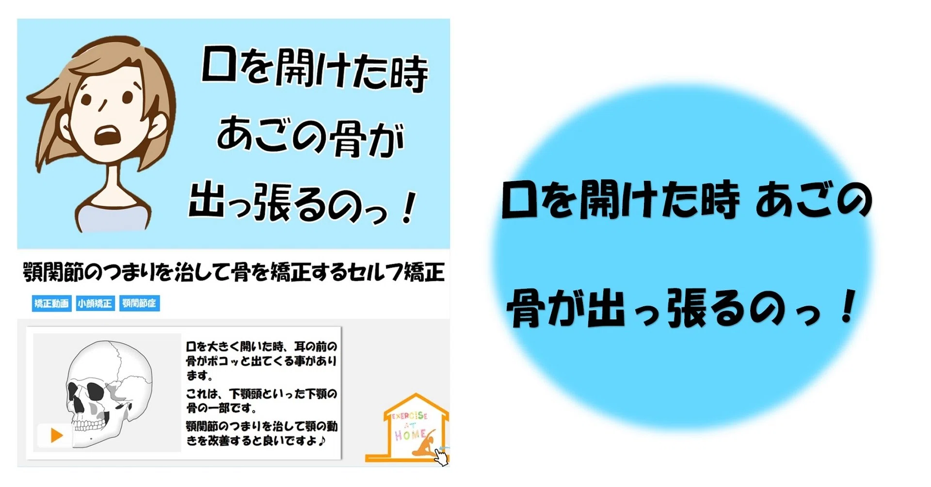 口を開けた時 あごの骨が出っ張るのっ Revisionginza Note