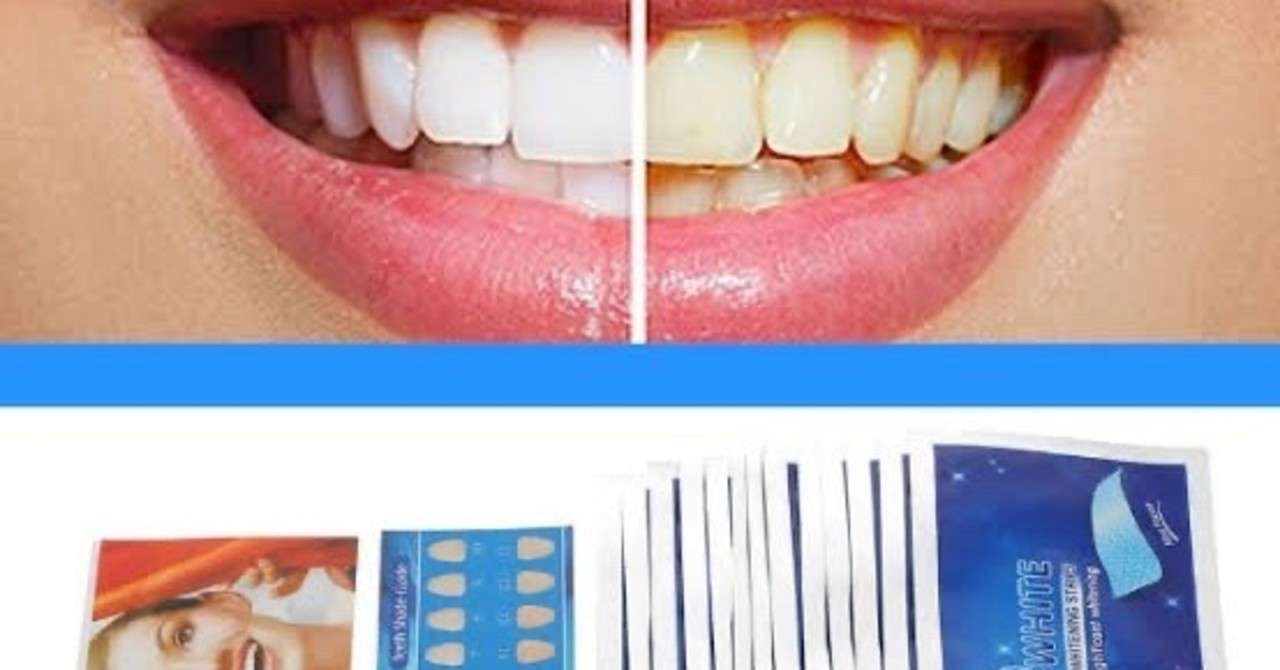 自宅で簡単効果抜群のホワイトニングテープとは アメリカでは主流 Tackeyblog Note