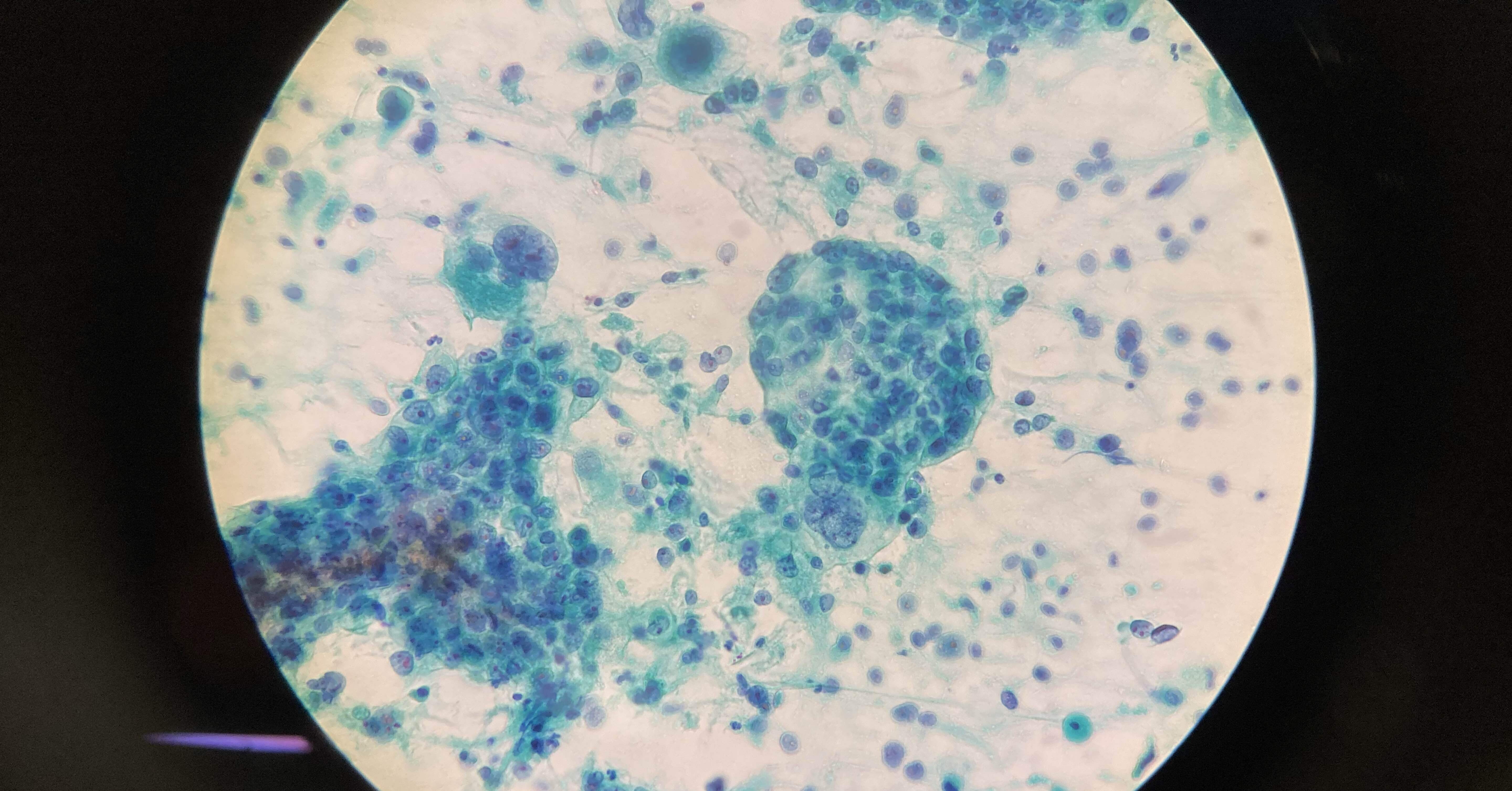 ここが嫌だよ細胞診~細胞検査士を目指す小僧の悩み~｜Yama_takenoko