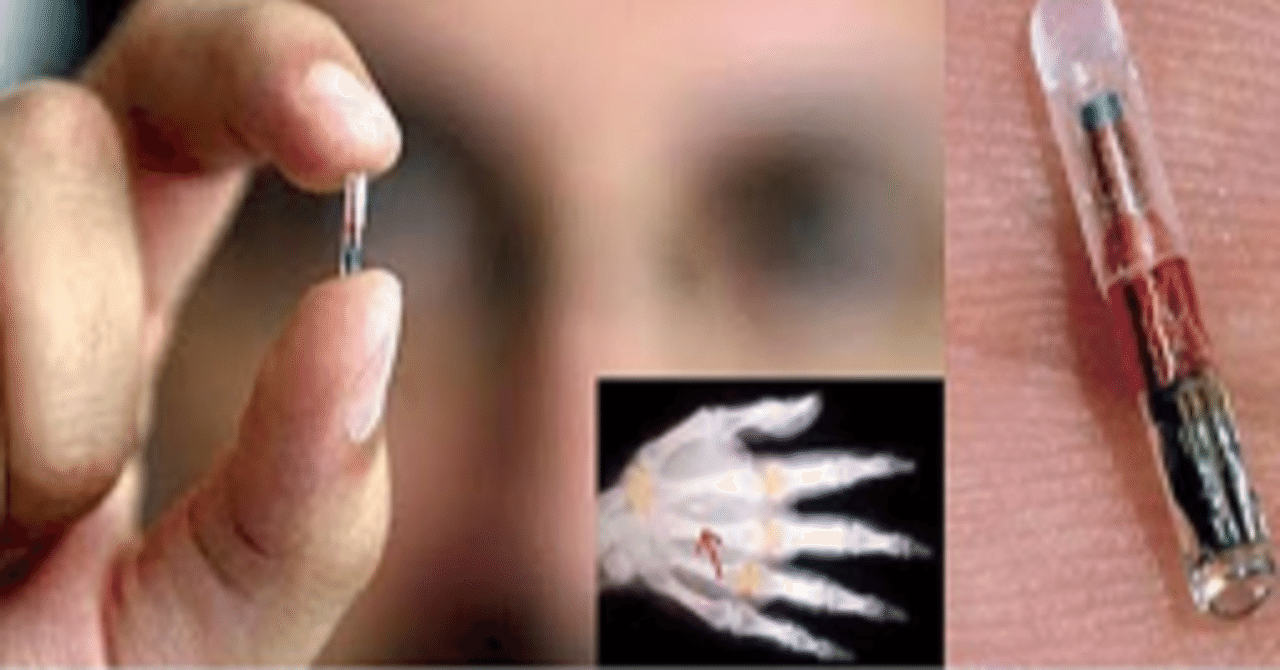 これから人間マイクロチップを選択する時がきます あなたはどうしますか Ryu Miya パーソナリティクリエイター Note