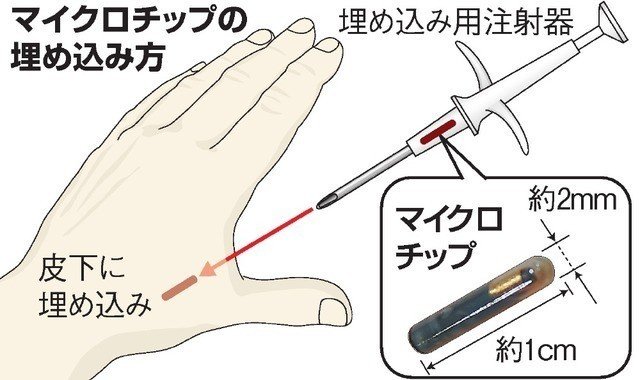 これから人間マイクロチップを選択する時がきます あなたはどうしますか Ryu Miya パーソナリティクリエイター Note