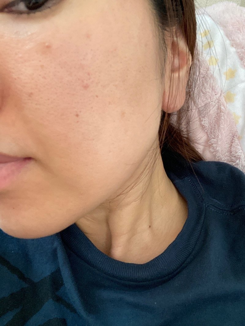 脱皮クリーム レチノールa 1 の体験口コミ アラサーolちゃん Note