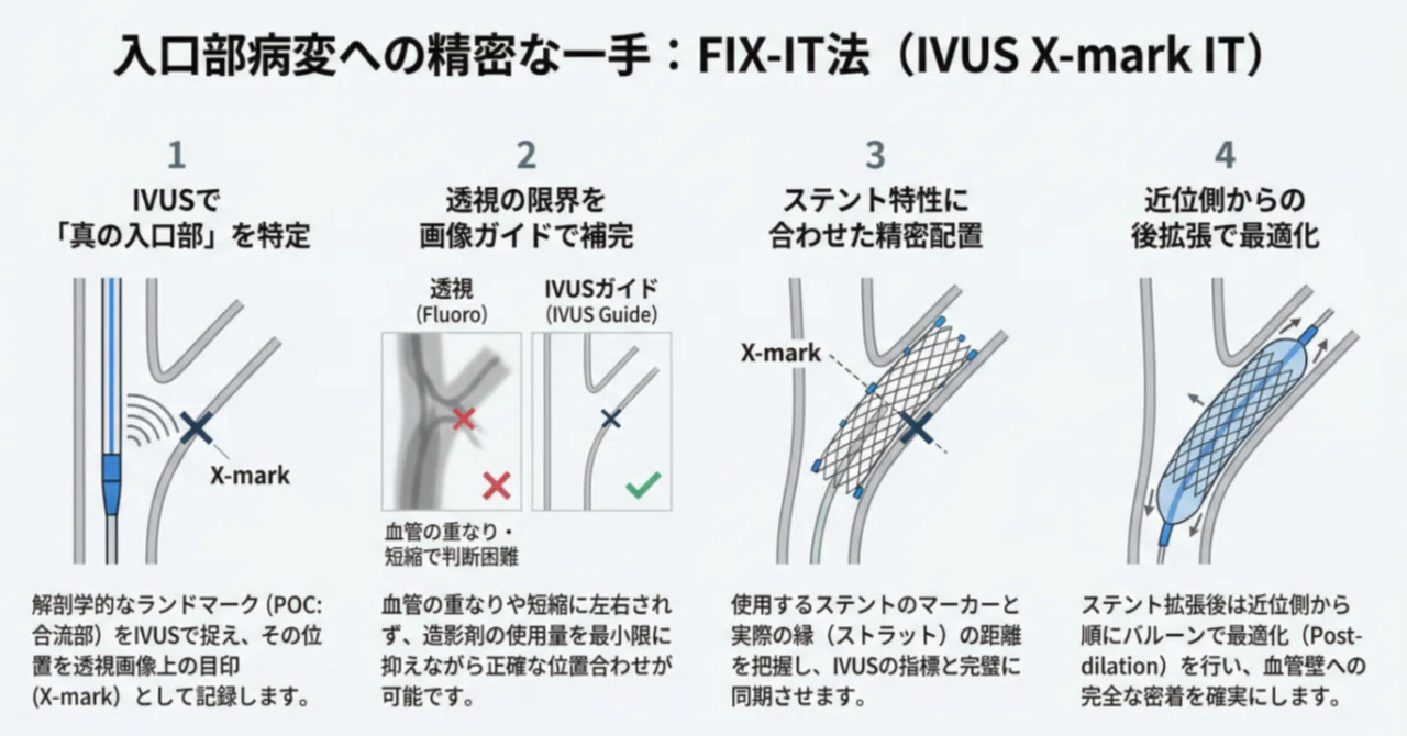 血管の施し　Foil４枚 心カテ)IVUSと透視を融合した入口部ステント留置術「FIX-IT」とは