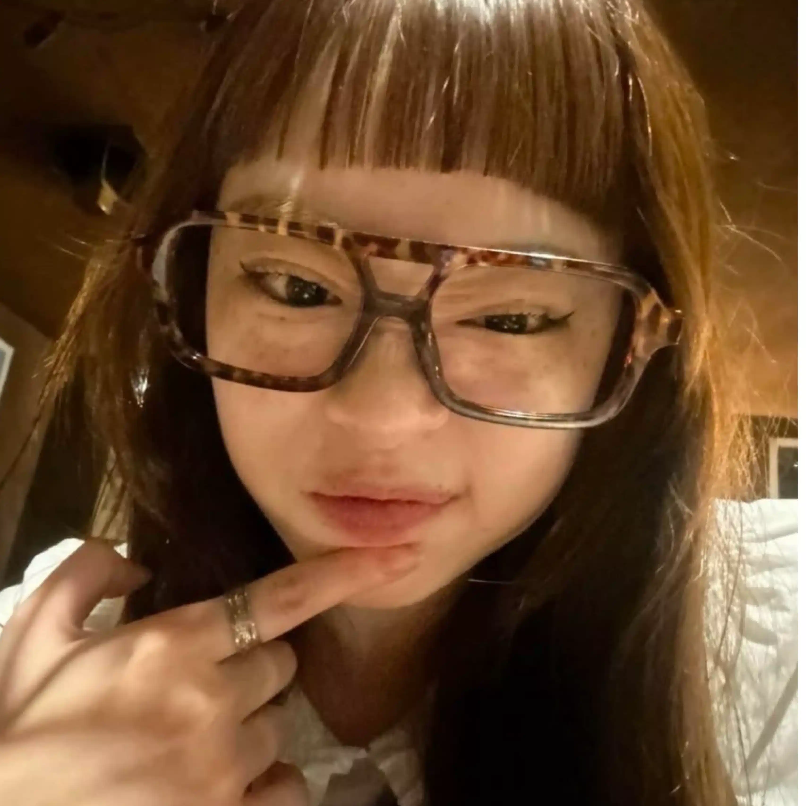 猫アレルギー