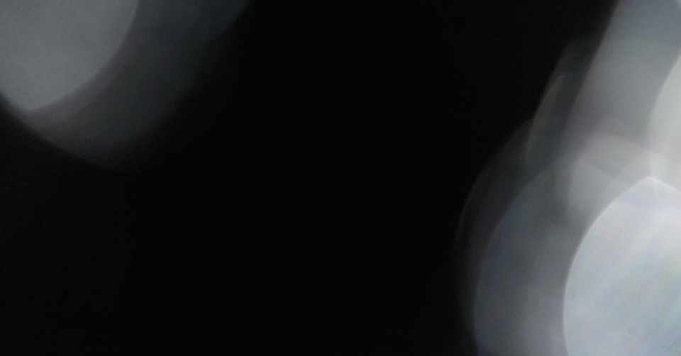 掲示板の闇 黒い薬草屋さん Note