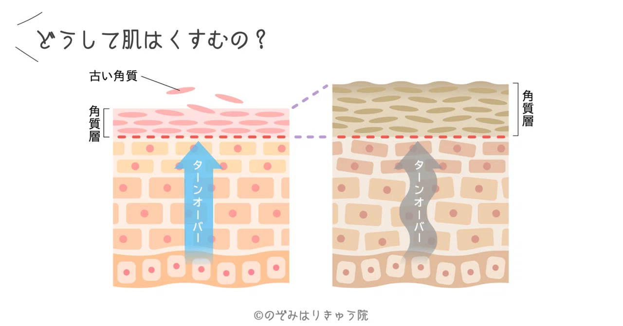 Q.どうして肌はくすむの?|のぞみはりきゅう院