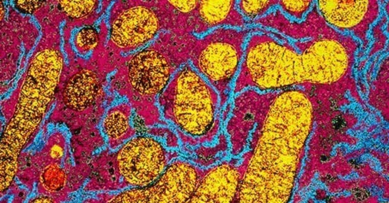 うつ病の原因は炎症だった : ミトコンドリア障害という、見落とされてきた原因