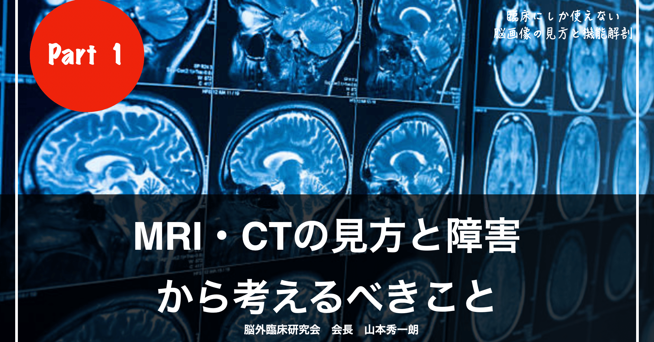 １話無料公開 サロンvip無料 5月9日開催セミナー 動画 資料 臨床にしか使えない脳画像の見方 Ctとmriの見方編 セミナー動画 脳外臨床研究会 脳外臨床大学校 Note