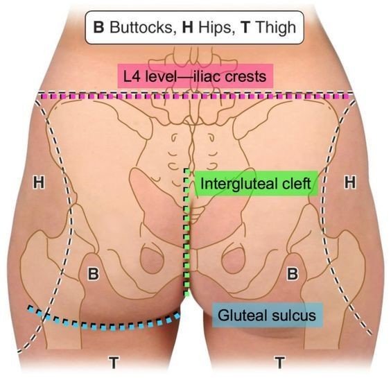 健康的にダイエット お尻と足のでっぱりについて考える 大転子って でっぱり を解消できるストレッチやトレーニング 読んだ人がちょっと元気になるブログ Note