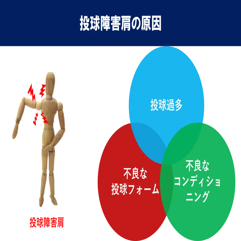 投球障害肩の病態と動作｜小林 弘幸