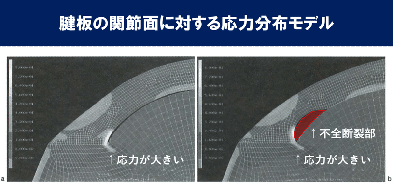 腱板の応力モデル