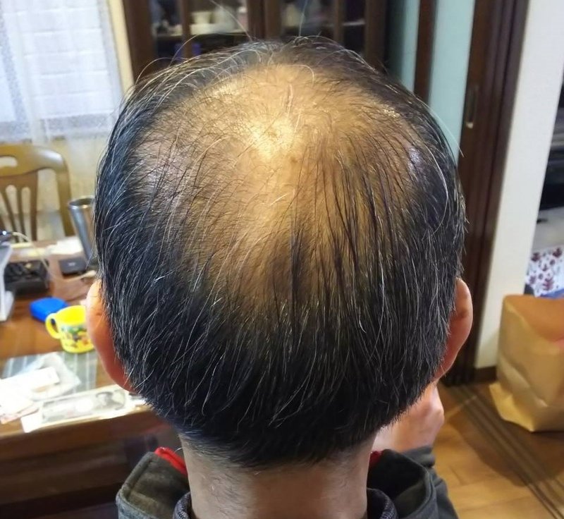 衝撃の事実 閲覧注意 Kakoi E Kakoiを世界ブランドへ Note 衝撃の事実 閲覧注意 Kakoi E Kakoiを世界ブランドへ Note