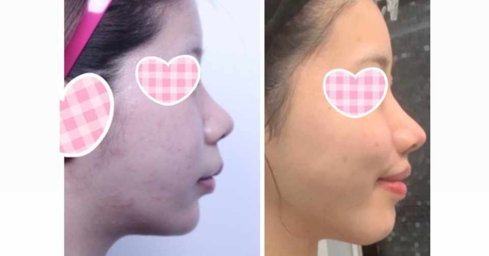 Eラインを求めた私の横顔遍歴 もはんしゅう Note