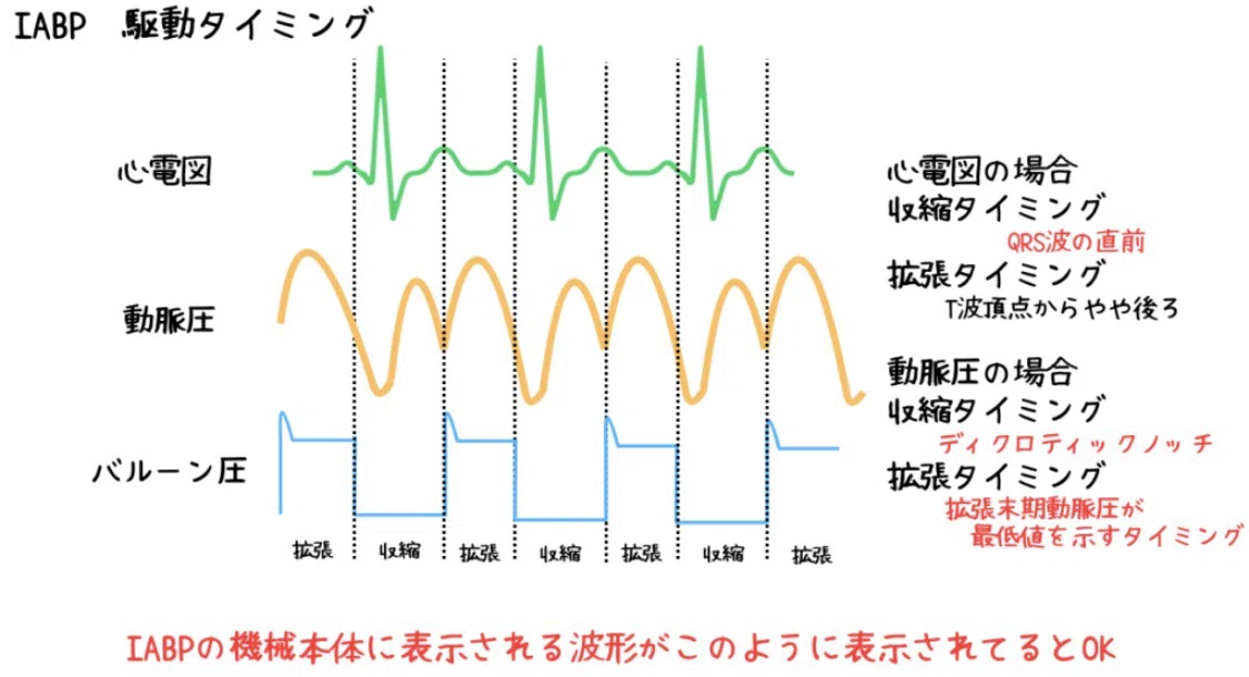 保存版 IABPが10倍楽しくなる 波形とタイミングの全知識 komatsu yuusuke CE