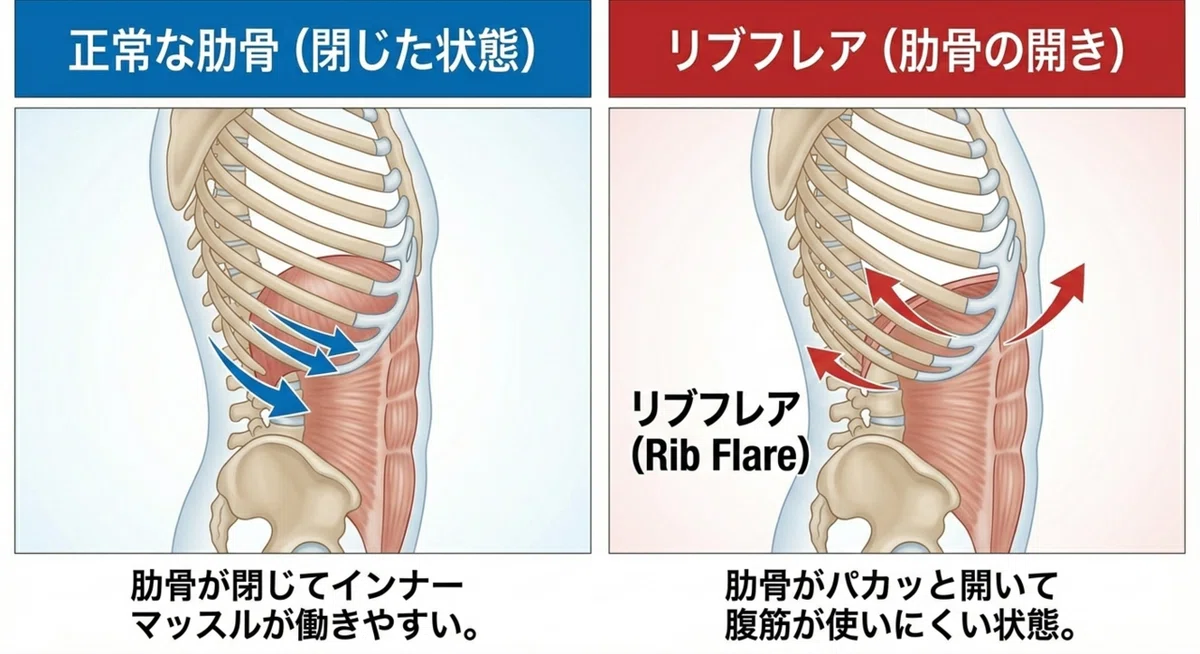 A Simple Explanation of Rib Flare (Flared Ribs)!｜レオ/理学療法士