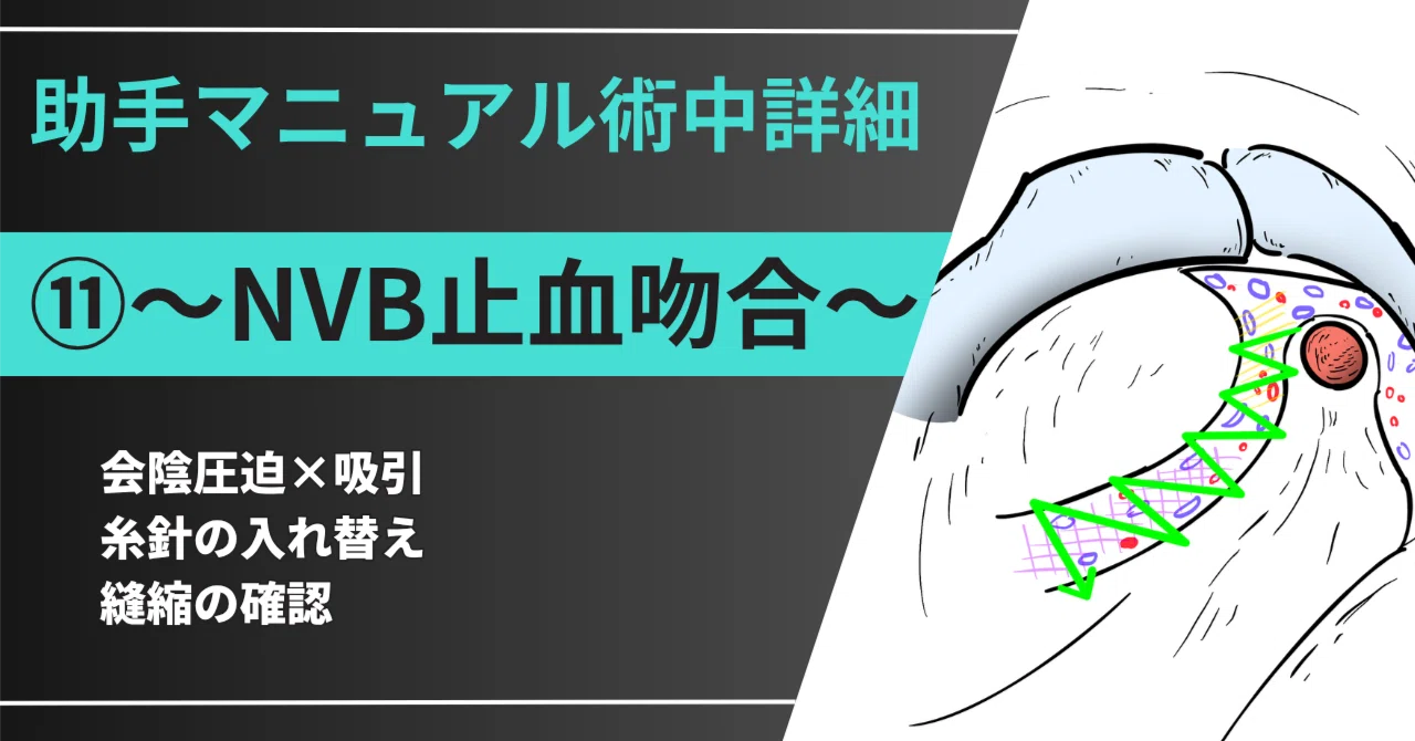 助手マニュアル術中詳細⑪〜NVB止血吻合〜｜青木啓介