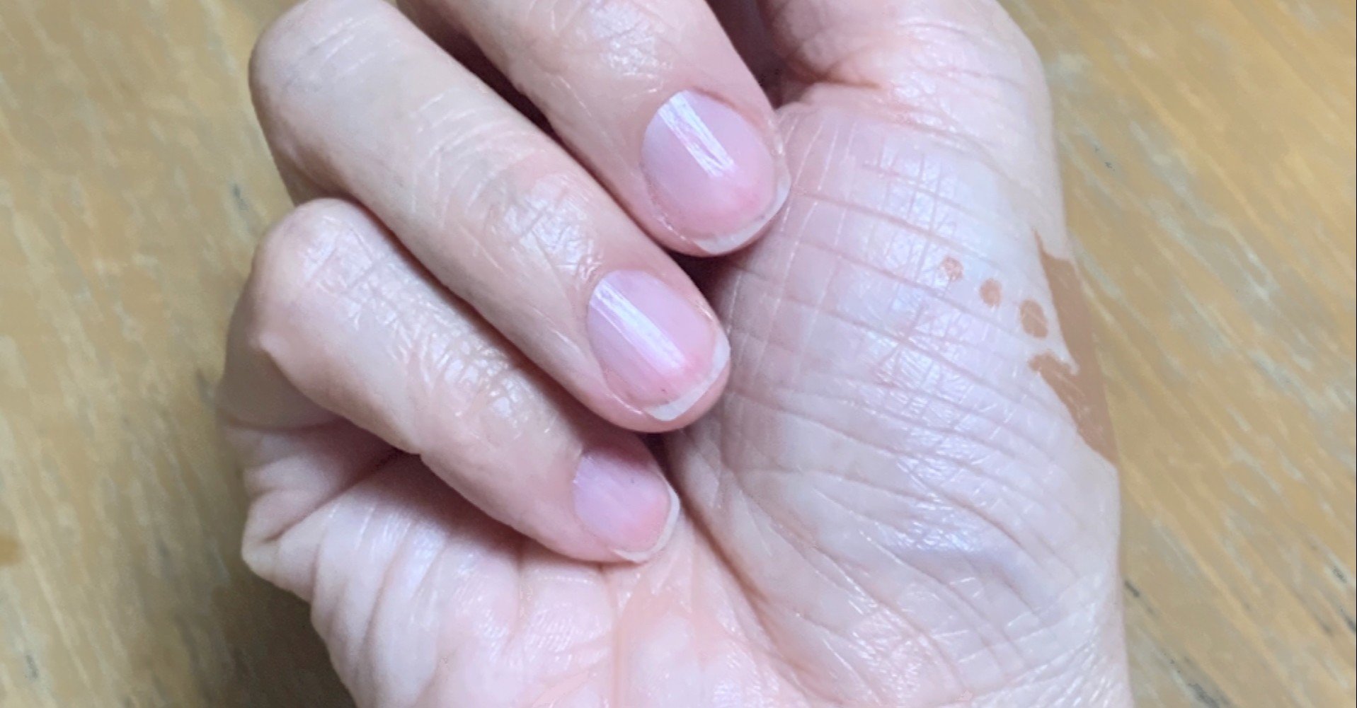 確信しているからこそ嫌いな爪でも自爪でいられる 自爪ケア伝道師 Kayo Note 確信しているからこそ嫌いな爪でも自爪でいられる 自爪ケア伝道師 Kayo Note