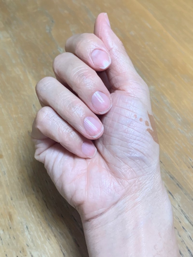 確信しているからこそ嫌いな爪でも自爪でいられる 自爪ケア伝道師 Kayo Note